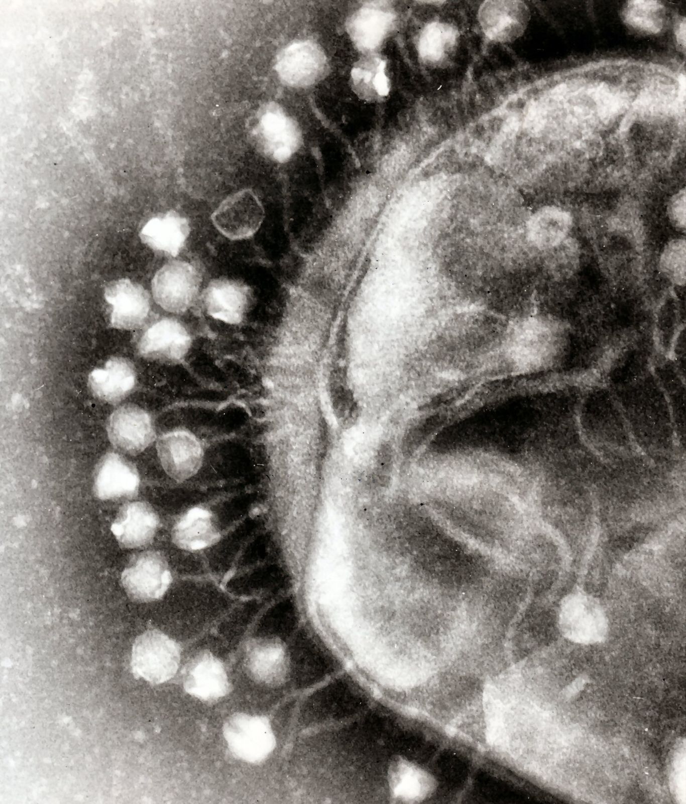 Electron micrograph of viruses attached to a bacterium