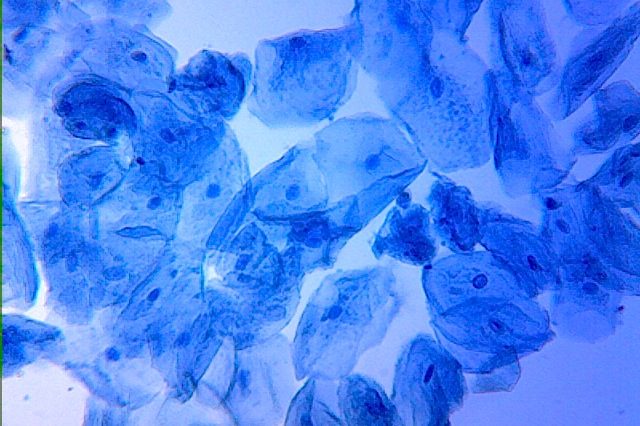 Human cheek cells stained blue, each a flat irregular shape with a darker nucleus