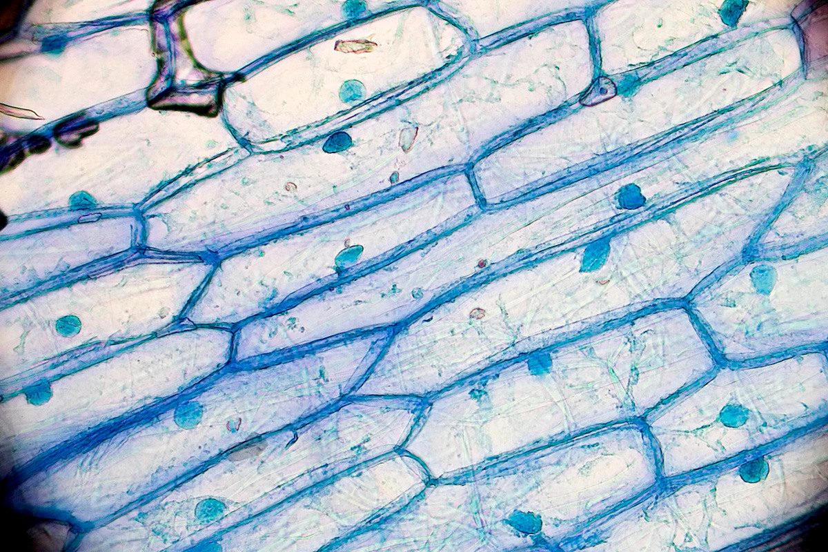 Onion skin cells under a microscope, stained blue, each with a dark nucleus